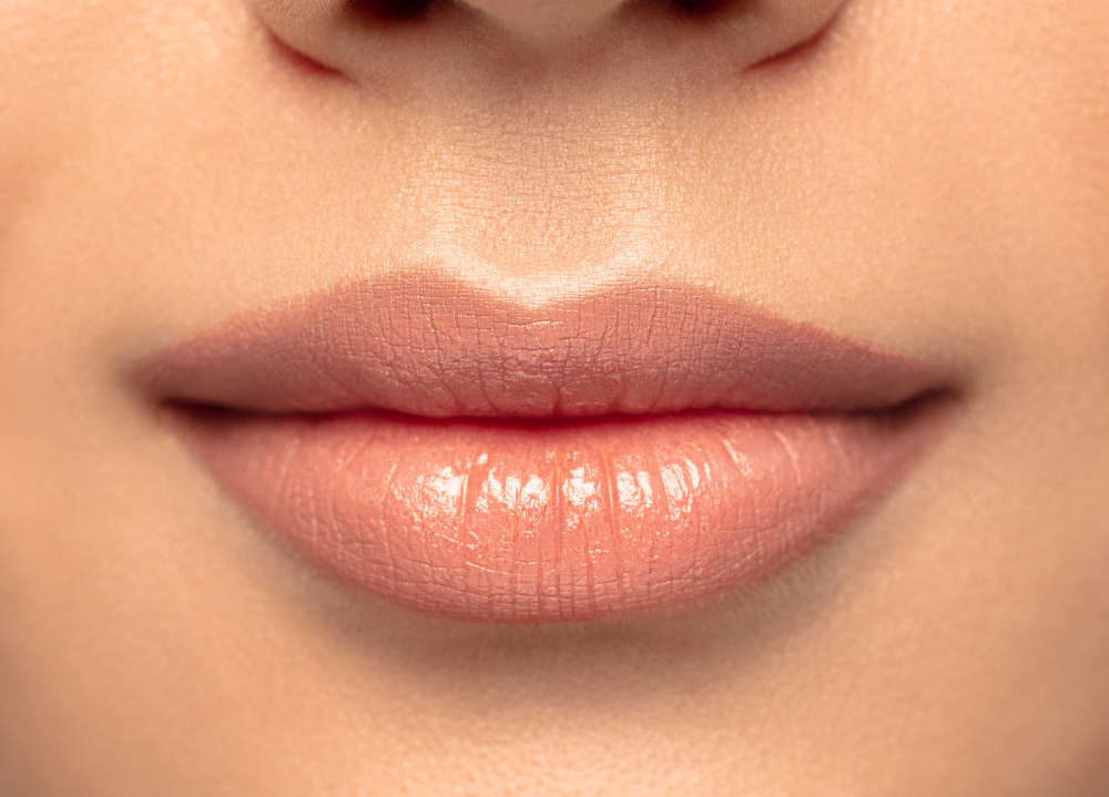 Filler Labbra